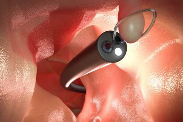 Gastroendo Rio de Janeiro RJ Gastroenterologia Exames Colonoscopia